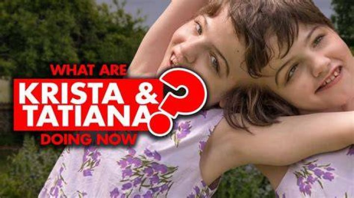 Journey of the Unbreakable Bond: Conjoined Twins Tatiana and Krista 2024